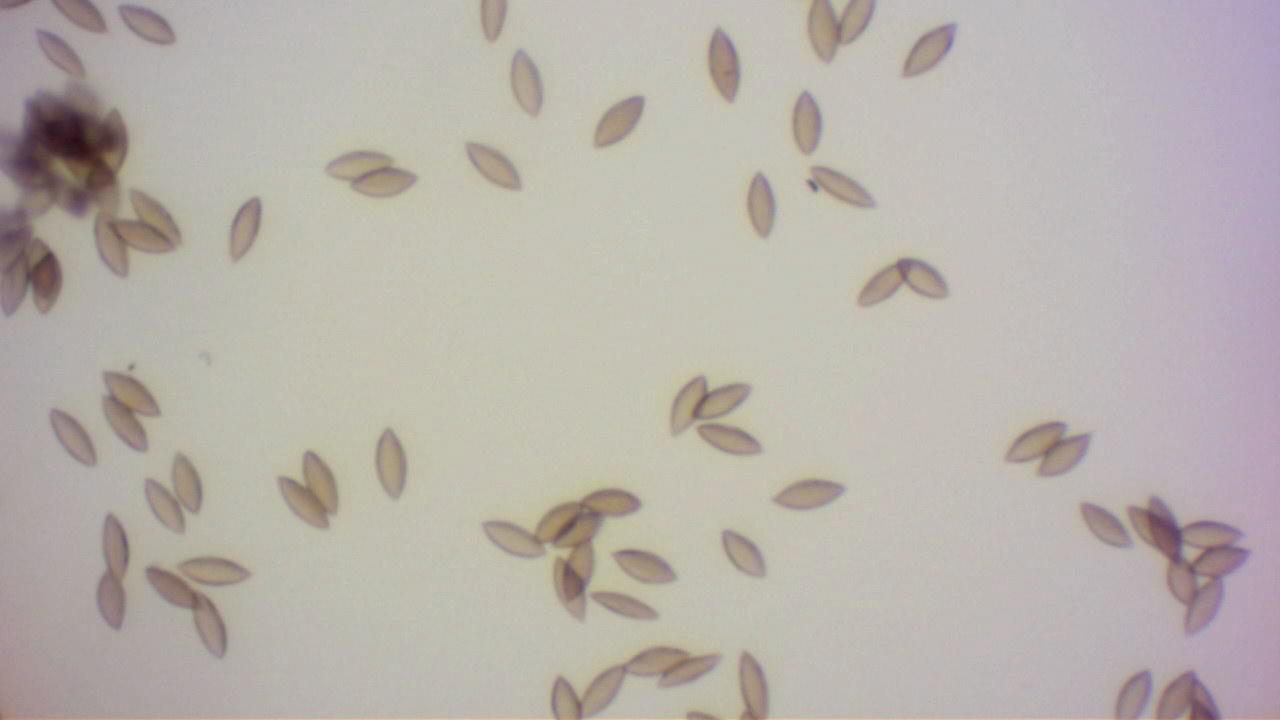 Microscopy of brown, oblong, apiculate Cocoicola californica spores at high magnification